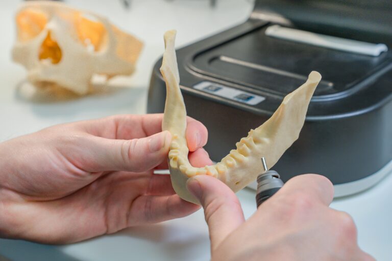 dental implants Newcastle
